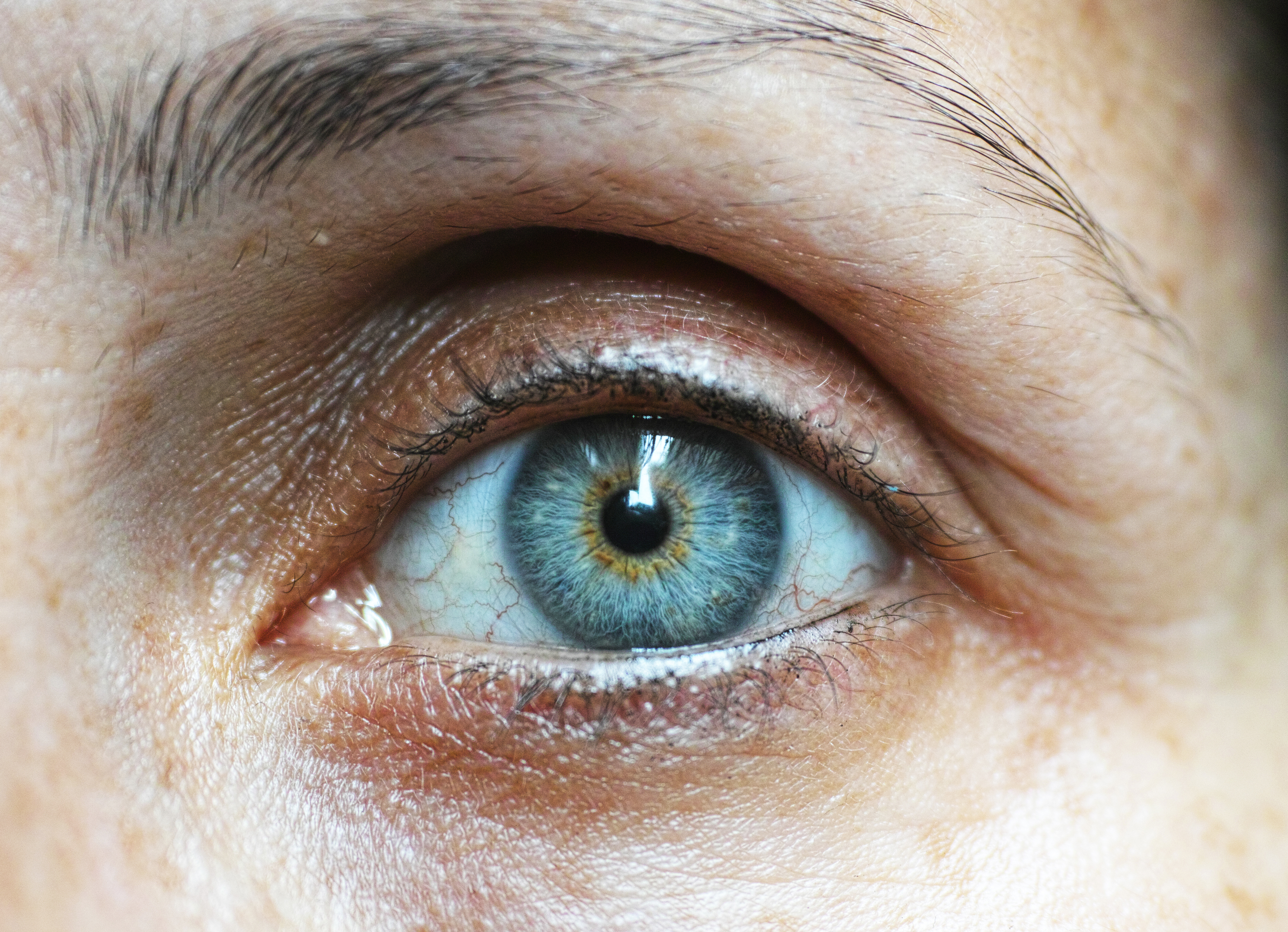 An Oral Probiotic Can Treat Dry Eye Disease